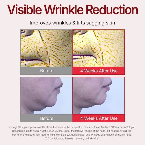 Instant Wrinkle Cream